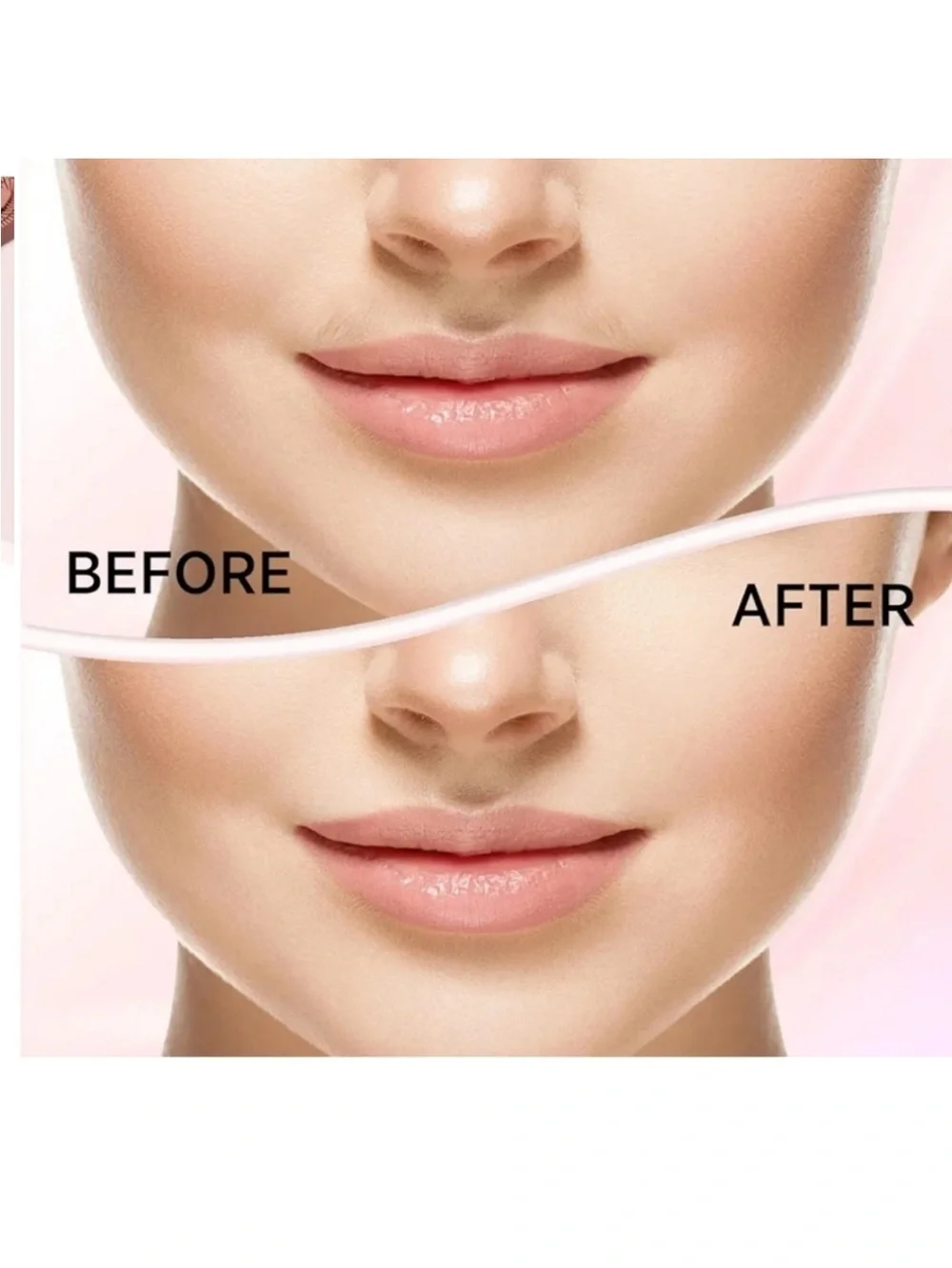 Facial Hair Removal pink new